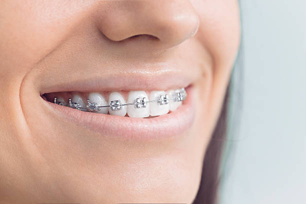 Best Cosmetic Dentistry  in Leland Grove, IL